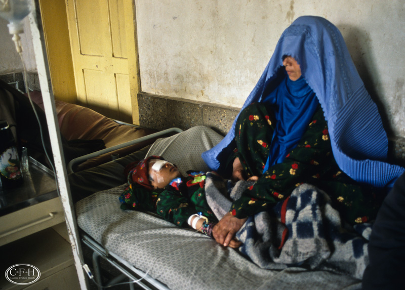Qandygul after double cataract surgery at five or six years old.
